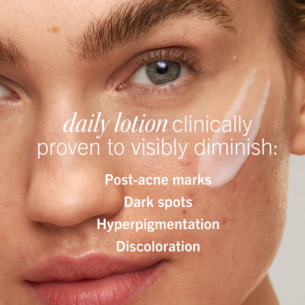 Ultimate Acne Solutions Routine - Image 12