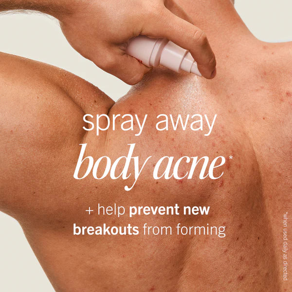 Ultimate Acne Solutions Routine - Image 3
