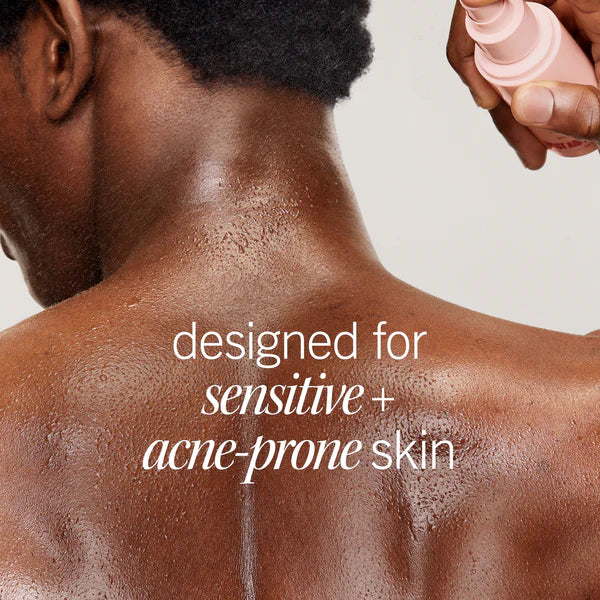 Ultimate Acne Solutions Routine - Image 8