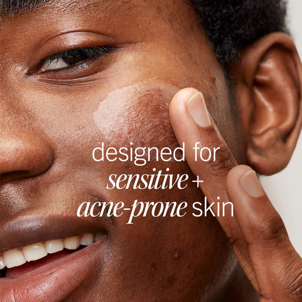 Ultimate Acne Solutions Routine - Image 14