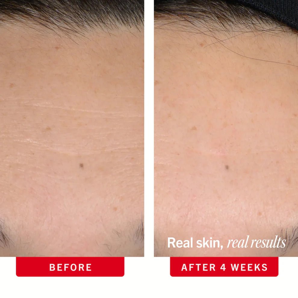 Face-Firming Duo - Image 4