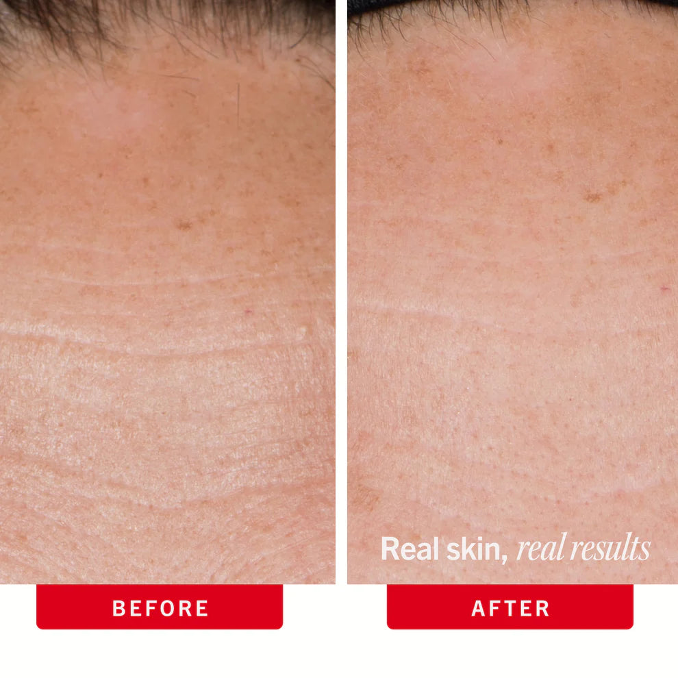 Dry Skin Duo - Image 9