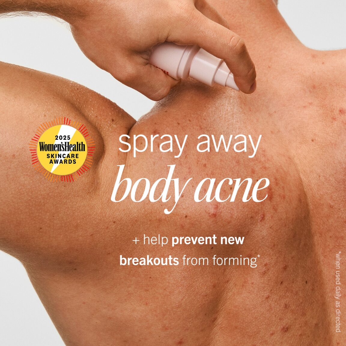Body Acne Clearing Mist with 2% Salicylic Acid - Image 2