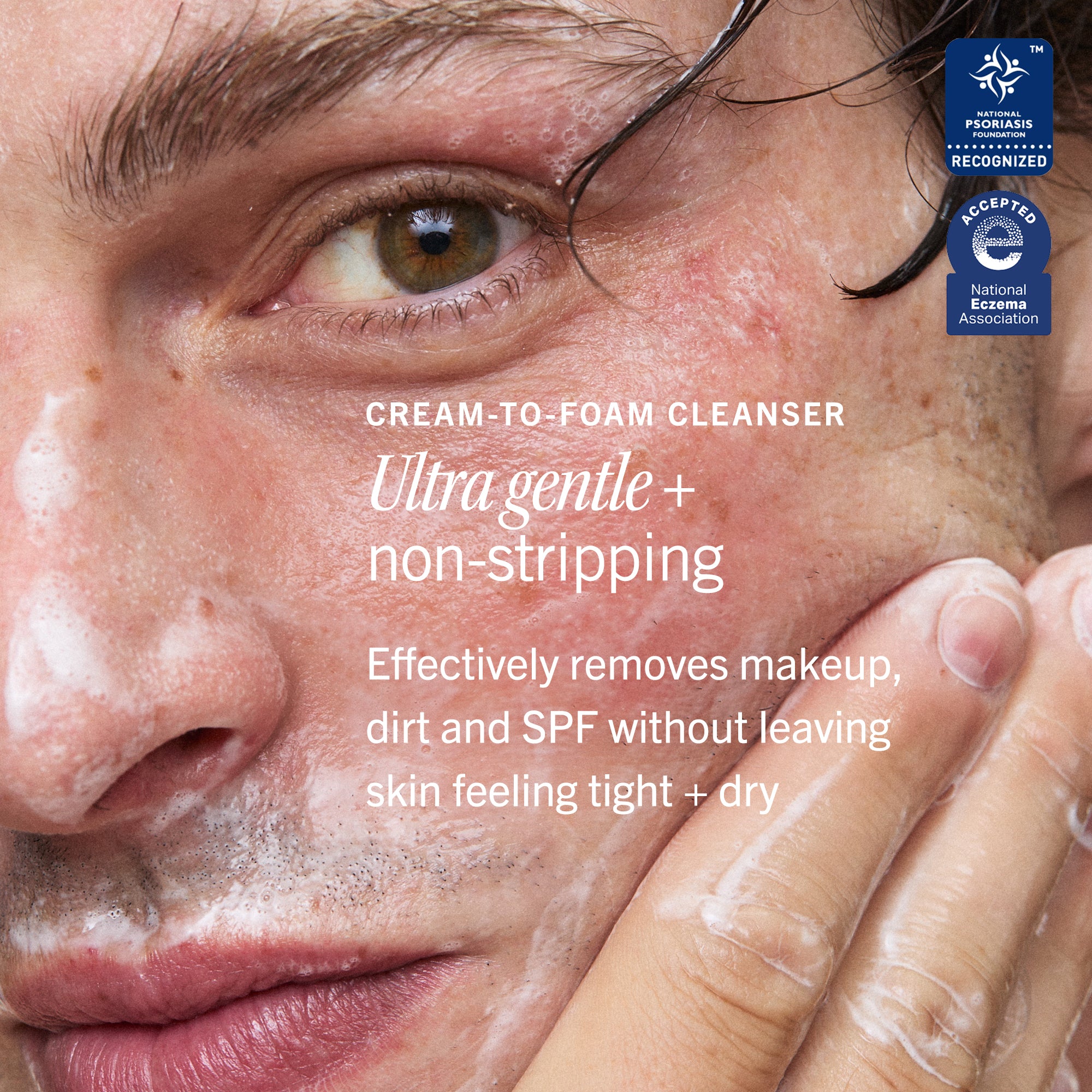 Dry Skin Rescue Kit - Image 8