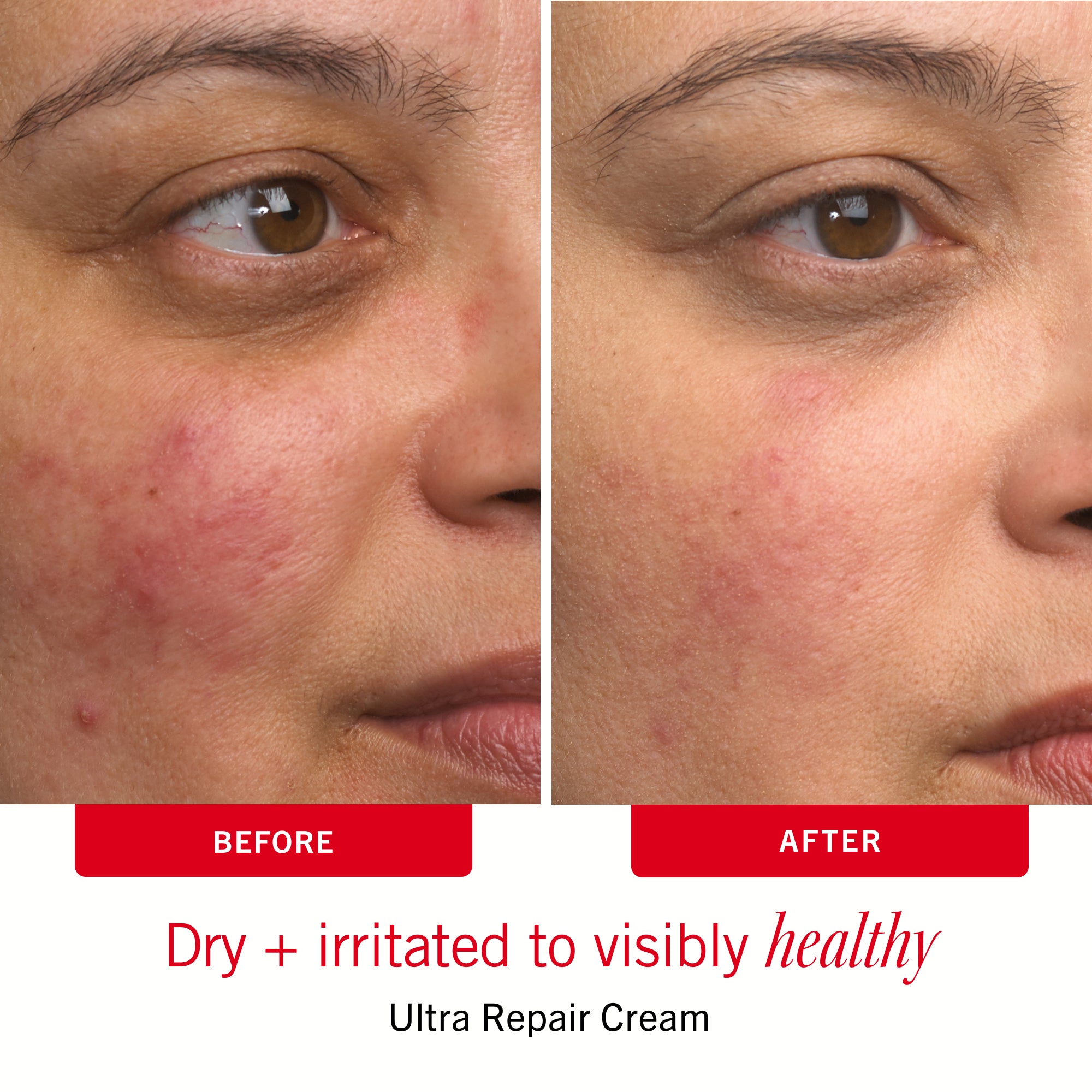 Sensitive Skin Bestsellers - Image 9