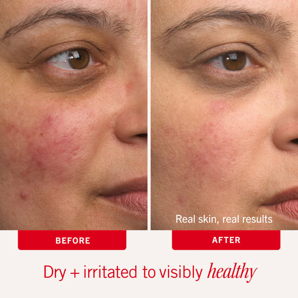 Clear Up + Hydrate Trio - Image 7